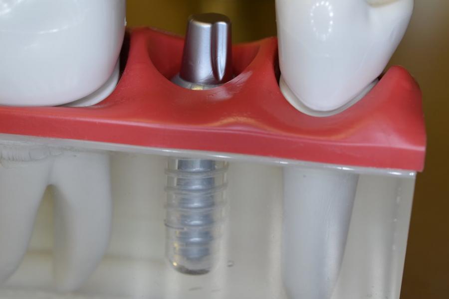 Implantate